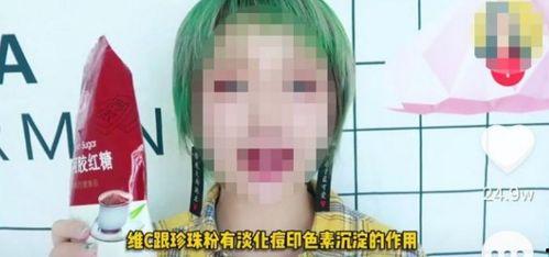 抖音网红阿銮吃瓜,揭秘抖音网红的幕后故事